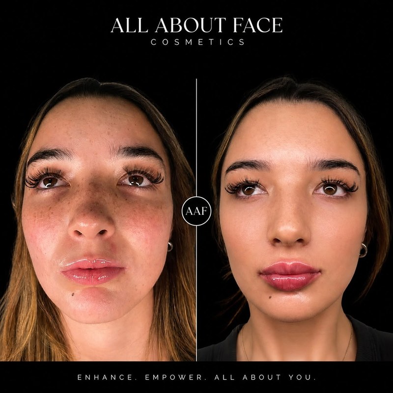 Side-by-side clinical photographs showing a face from the front.